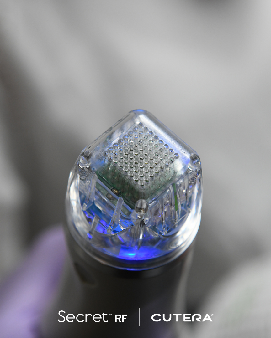 SecretRF Microneedling