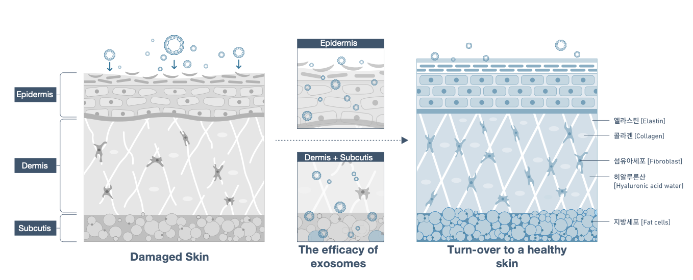 Diagram of skin layers and exosomes' role in healing damaged skin
