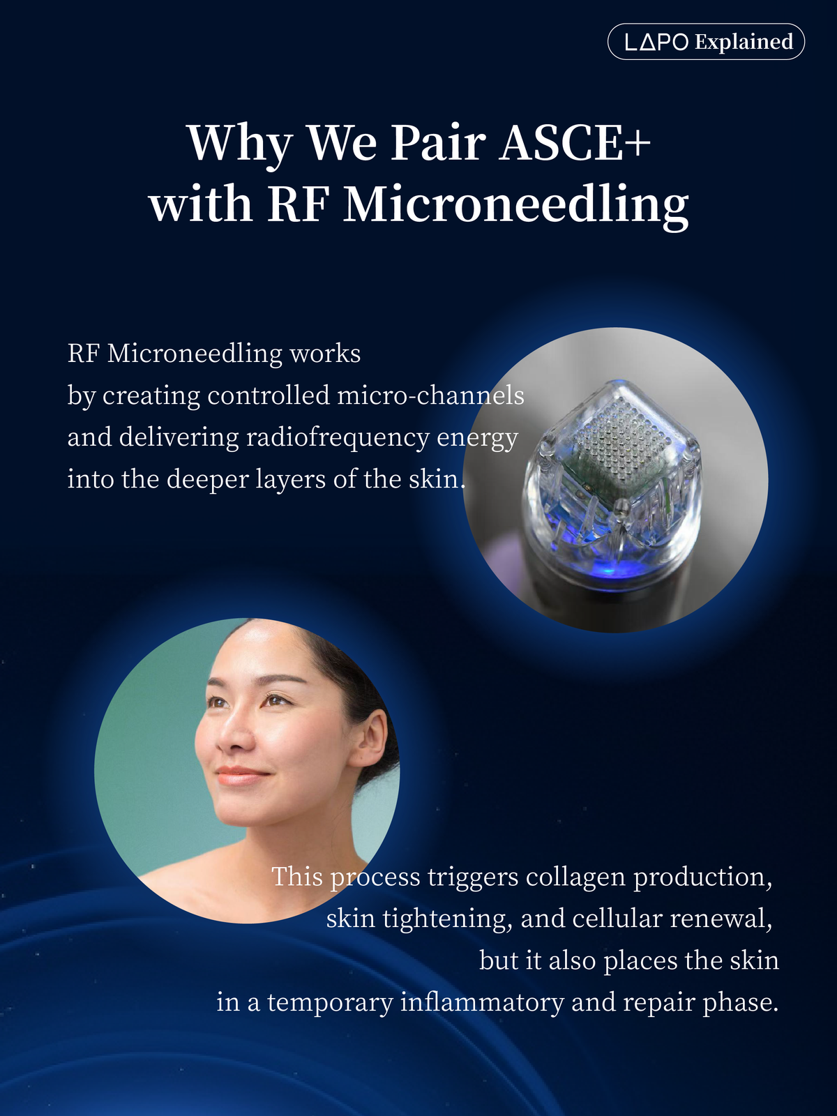 ASCEplus SRLV Exosome Therapy – LAPO Skincare