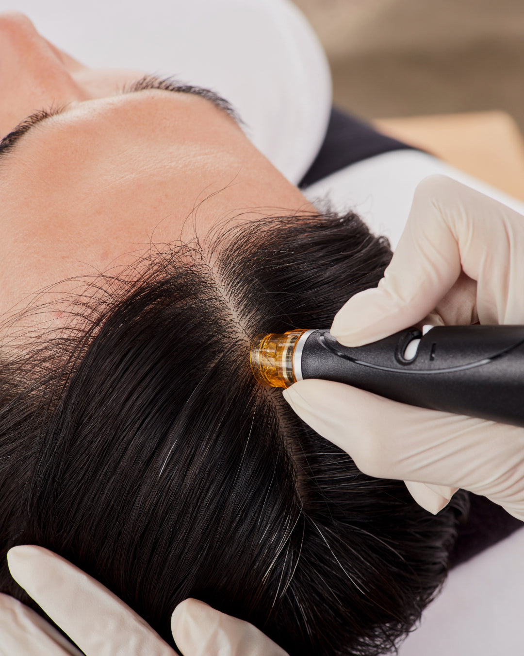 Keravive Peptide Scalp Treatment