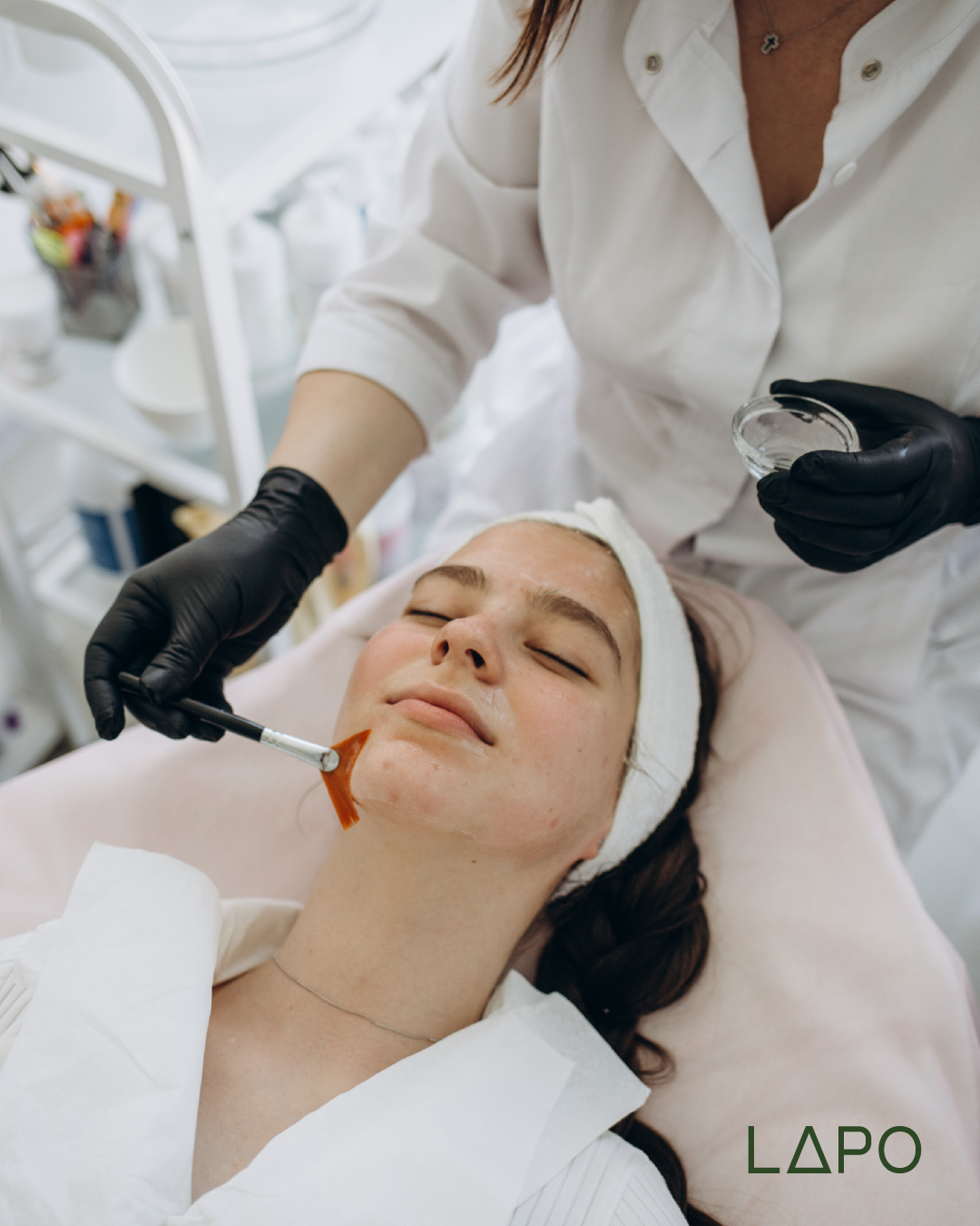 Chemical Peel (19% Azelaic Acid)