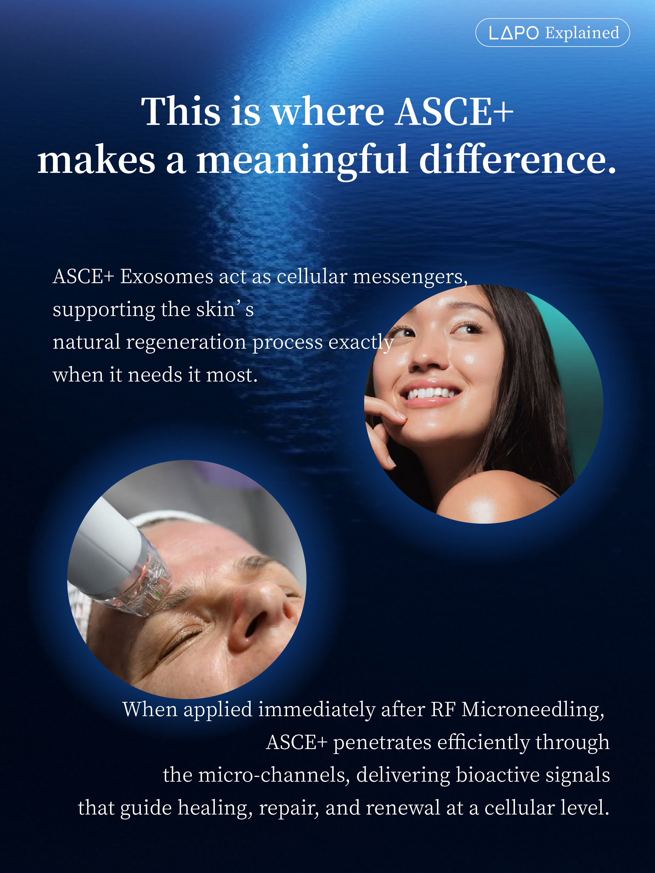 ASCEplus SRLV Exosome Therapy